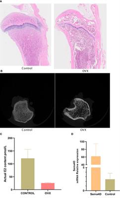 Leptin and melatonin’s effects on OVX rodents’ bone metabolism